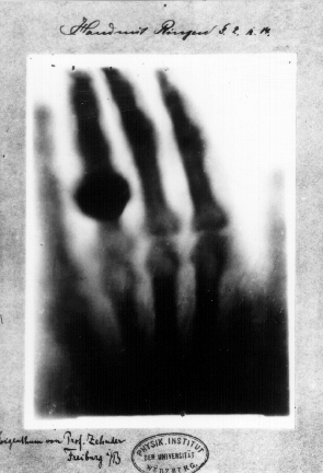 First-x-ray