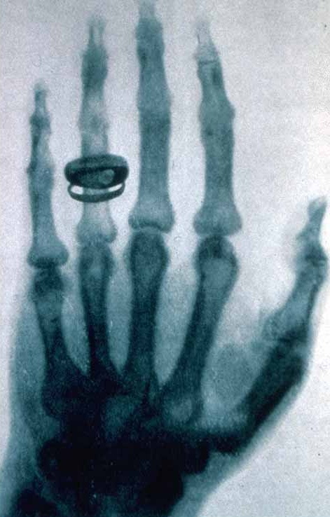 First-x-ray